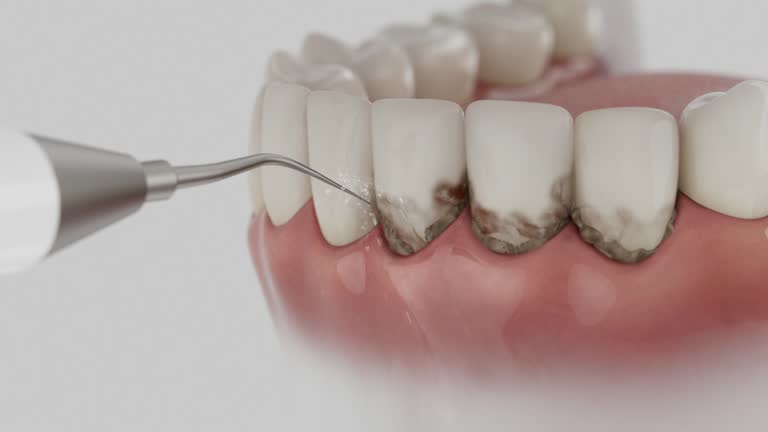 Reliable Dental contractor in Hamilton, TX by Smile Center Dentistry